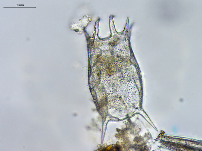 Keratella quadrata, Grisolles 31, avril 2020 &copy; Anaëlle Bernard